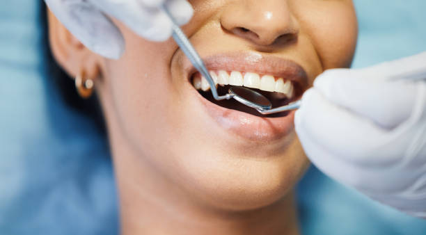 Best Emergency Root Canal Therapy in Evanston, IL