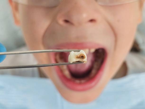 Best Emergency Denture Repair in Evanston, IL